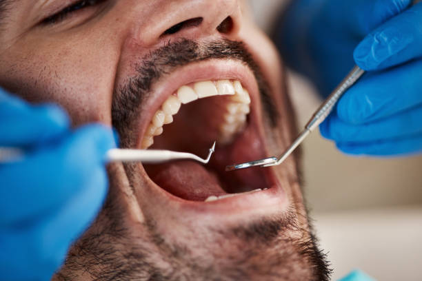 Emergency Dental Services in Lovington, IL